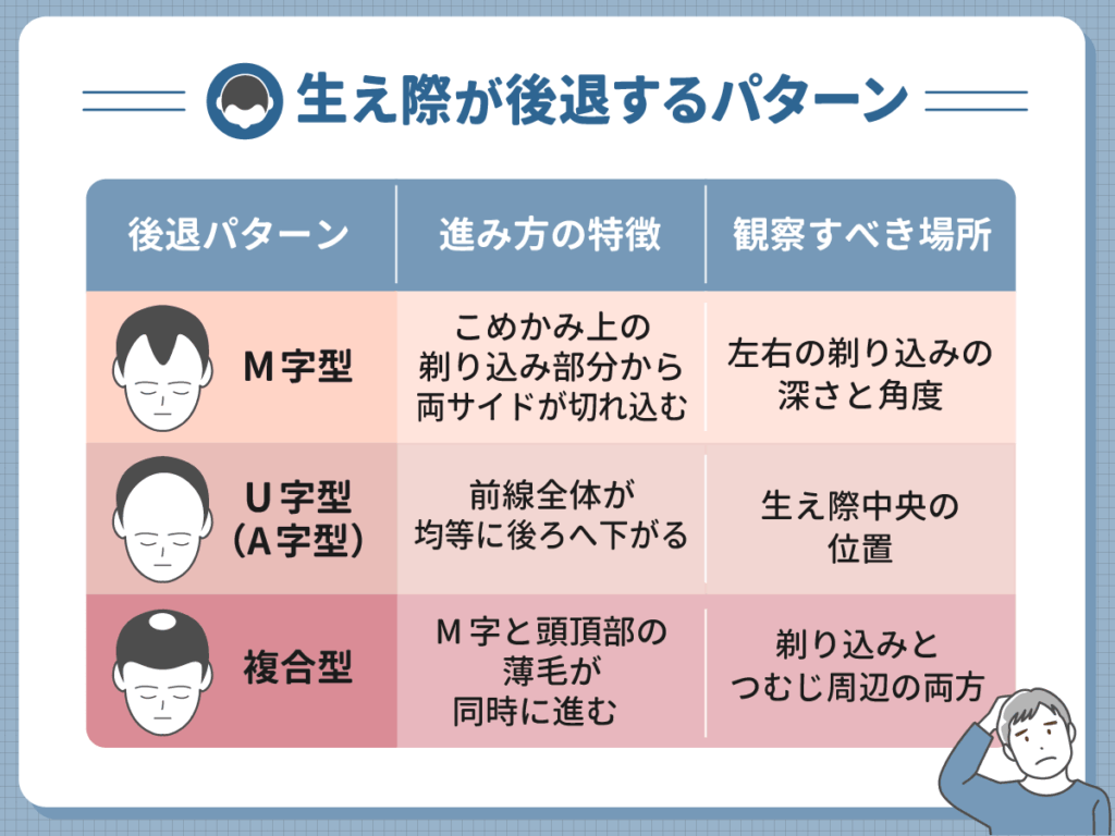 生え際が後退する主なパターン