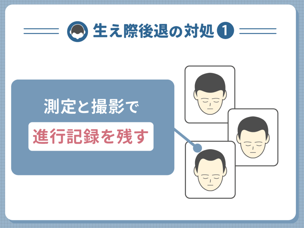 生え際後退の対処①:測定と撮影で進行記録を残す