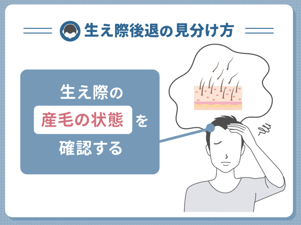 生え際後退の見分け方①:生え際の産毛の状態を確認する