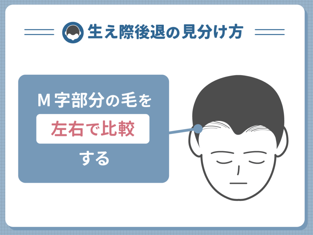生え際後退の見分け方②:M字部分の毛を左右で比較する
