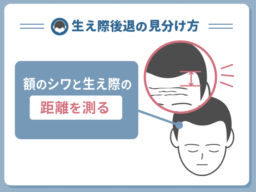 生え際後退の見分け方③:額のシワと生え際の距離を測る