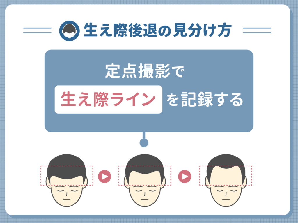 生え際後退の見分け方⑦:定点撮影で生え際ラインを記録する