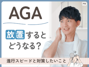 AGAを放置するリスクは?