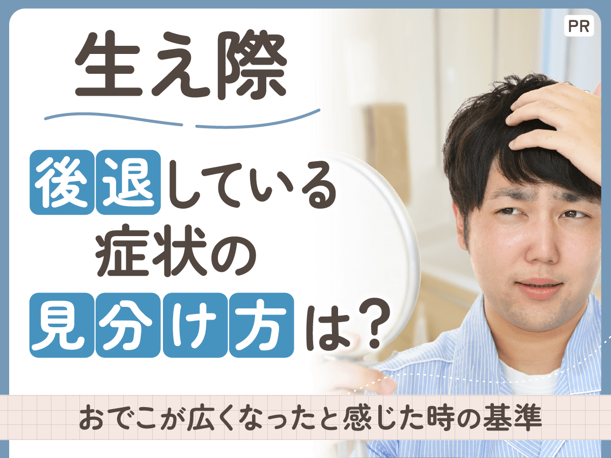 生え際後退の見分け方とは?おでこが広くなったと感じたときの判定基準と対処法を解説