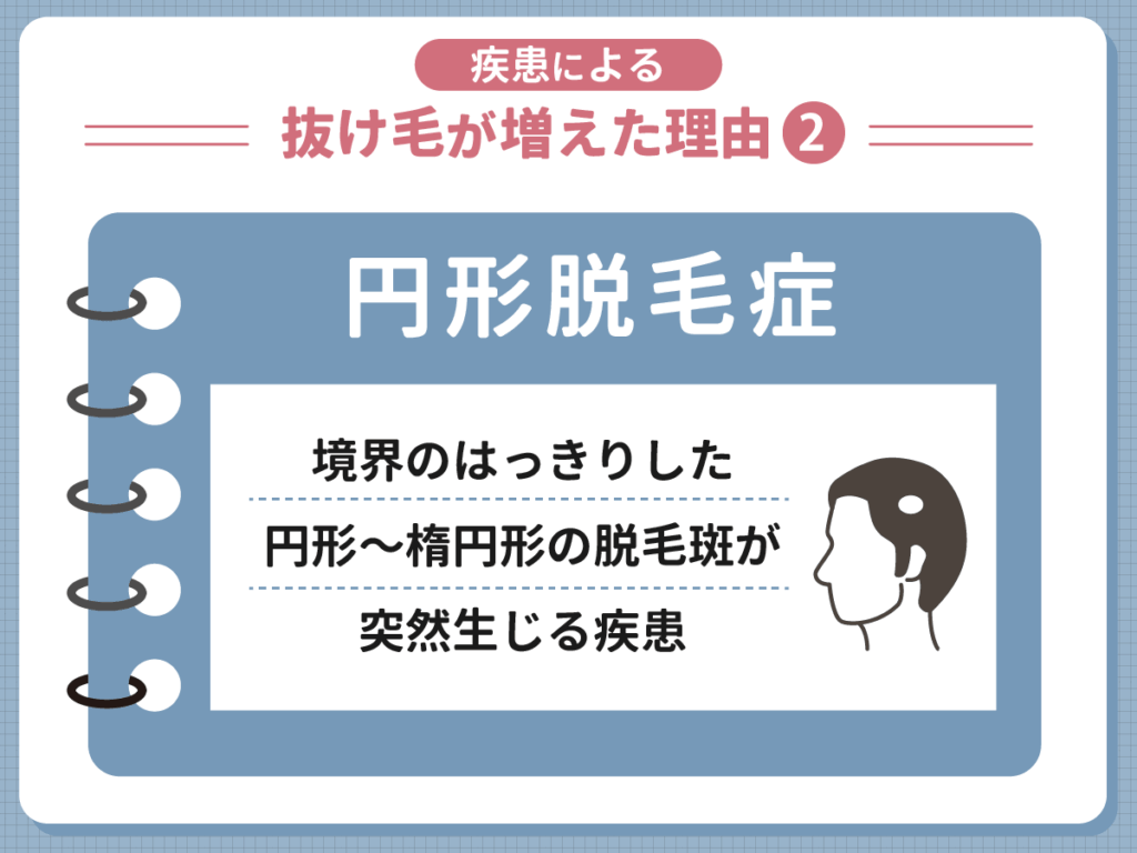 疾患による抜け毛が増えた理由②:円形脱毛症