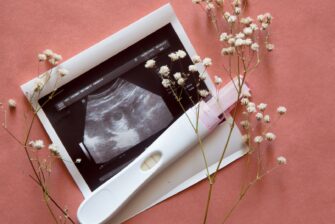 妊娠検査薬とエコー写真とかすみ草の画像